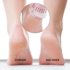 Anti-callus Rasp Ailoria Lustre